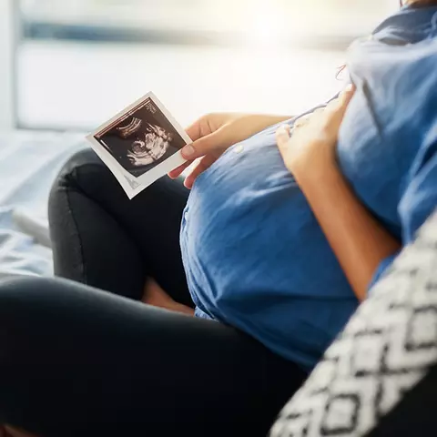 Schwangere hat ein Ultraschall-Bild in der Hand